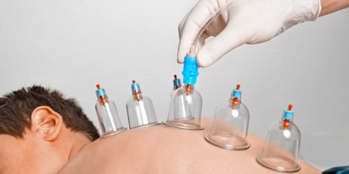 منظمة الصحة العالمية تقر العلاج بالحجامة